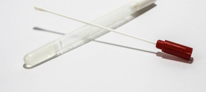 Gör ett mögeltest om det finns misstanke om svartmögel Gör ett mögeltest om det finns misstanke om svartmögel